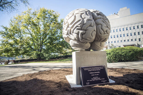 The Human Brain